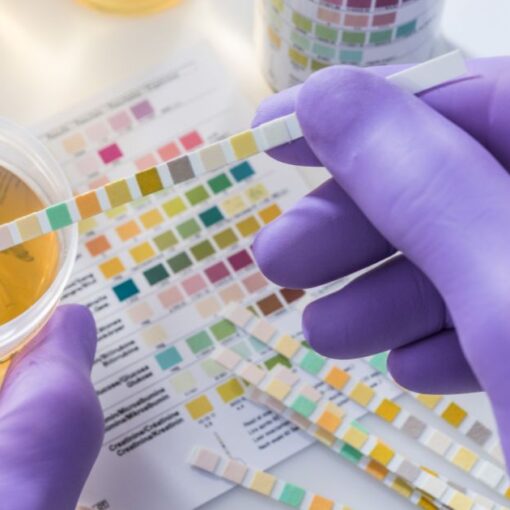 test antidroga